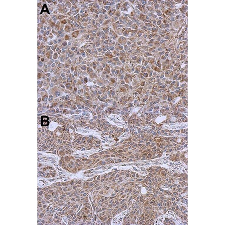 Immunohistochemistry - DLST antibody from Signalway Antibody (22024) - Antibodies.com