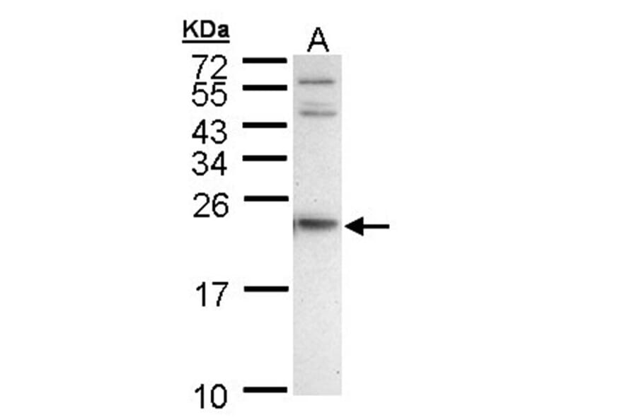 APRT antibody from Signalway Antibody (22026) - Antibodies.com