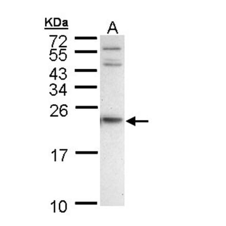 APRT antibody from Signalway Antibody (22026) - Antibodies.com