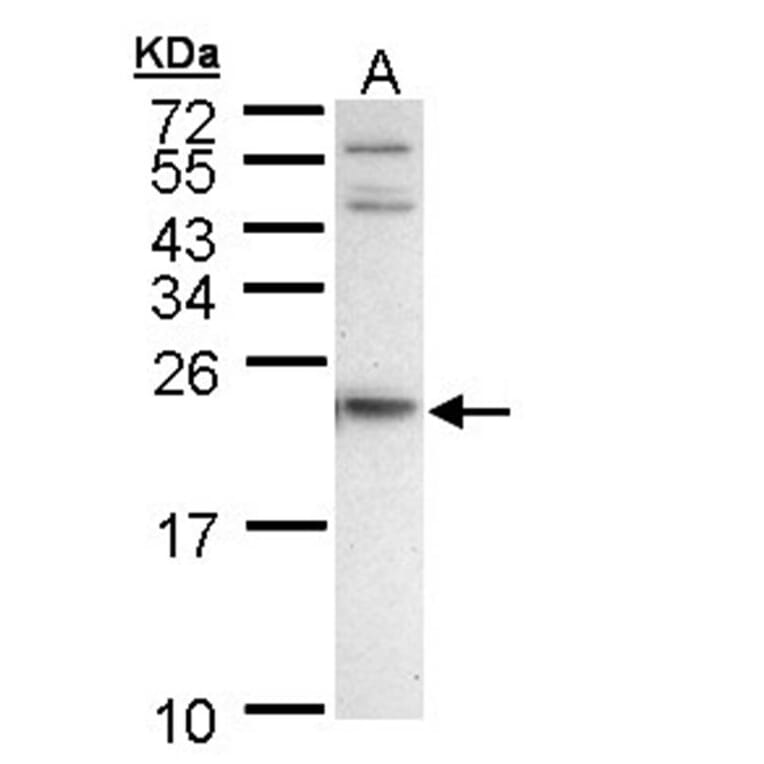 APRT antibody from Signalway Antibody (22026) - Antibodies.com