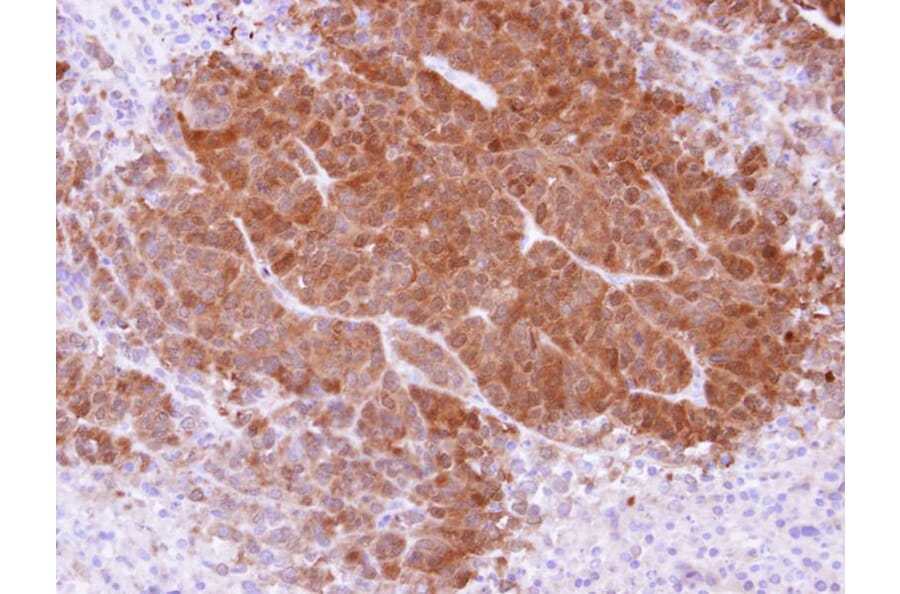 Immunohistochemistry - APRT antibody from Signalway Antibody (22026) - Antibodies.com