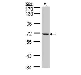 GLE1 antibody from Signalway Antibody (22060) - Antibodies.com