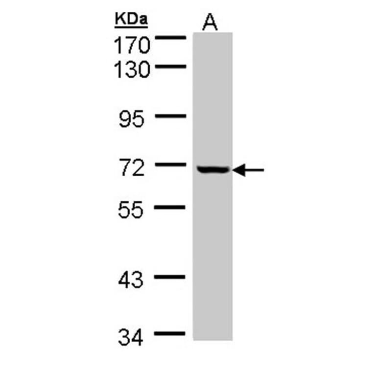 GLE1 antibody from Signalway Antibody (22060) - Antibodies.com