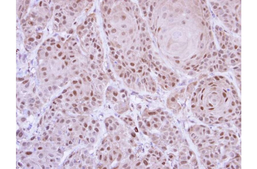 Immunohistochemistry - GLE1 antibody from Signalway Antibody (22060) - Antibodies.com