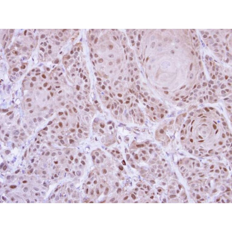 Immunohistochemistry - GLE1 antibody from Signalway Antibody (22060) - Antibodies.com