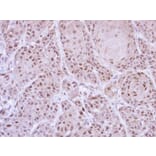 Immunohistochemistry - GLE1 antibody from Signalway Antibody (22060) - Antibodies.com