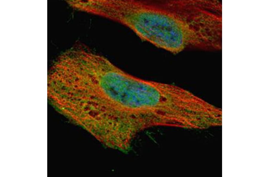 GLE1 antibody from Signalway Antibody (22060) - Antibodies.com