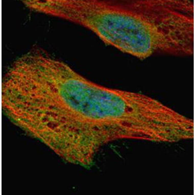 GLE1 antibody from Signalway Antibody (22060) - Antibodies.com