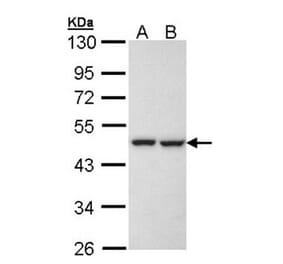KRR1 antibody from Signalway Antibody (22069) - Antibodies.com