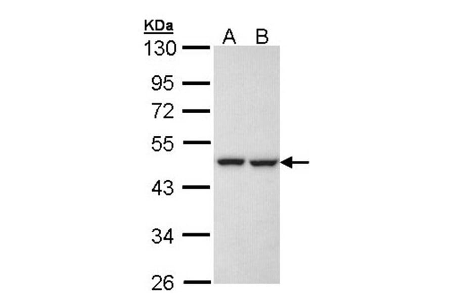 KRR1 antibody from Signalway Antibody (22069) - Antibodies.com