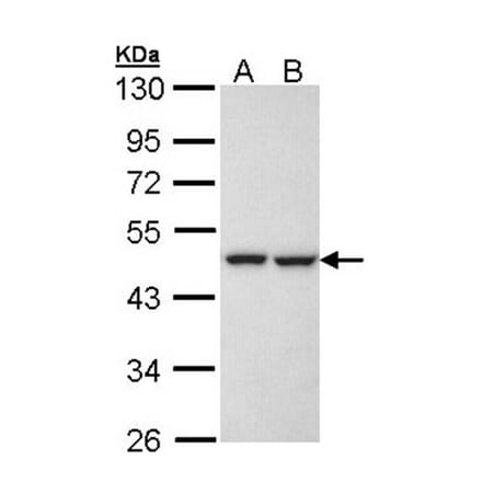 KRR1 antibody from Signalway Antibody (22069) - Antibodies.com