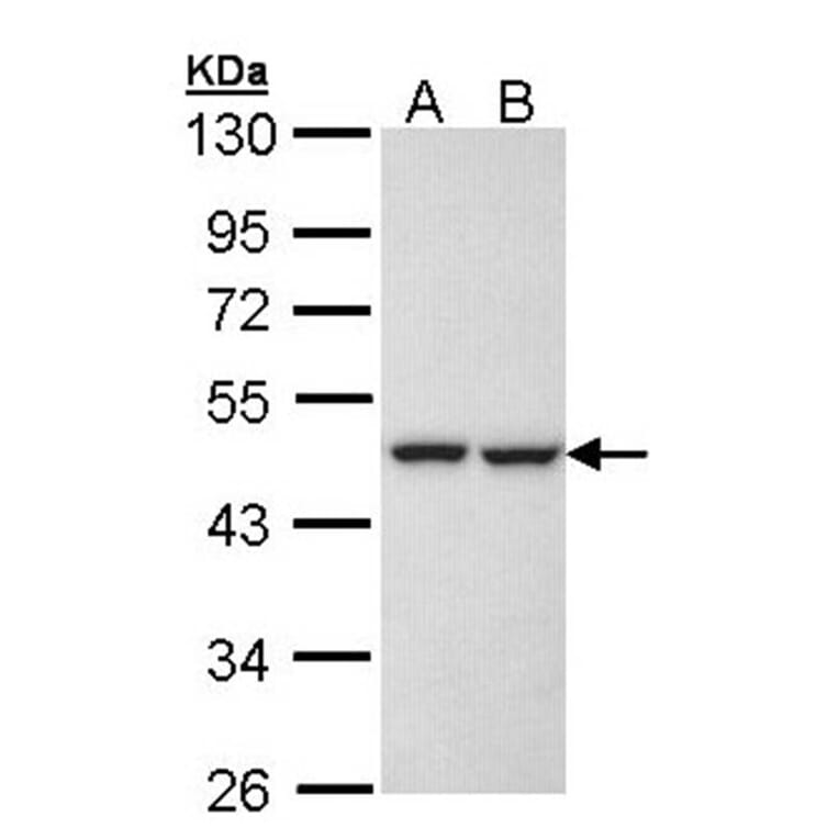 KRR1 antibody from Signalway Antibody (22069) - Antibodies.com