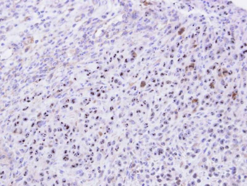 Immunohistochemical analysis of paraffin-embedded SAS xenograft, using KRR1 antibody at 1: 500 dilution.
