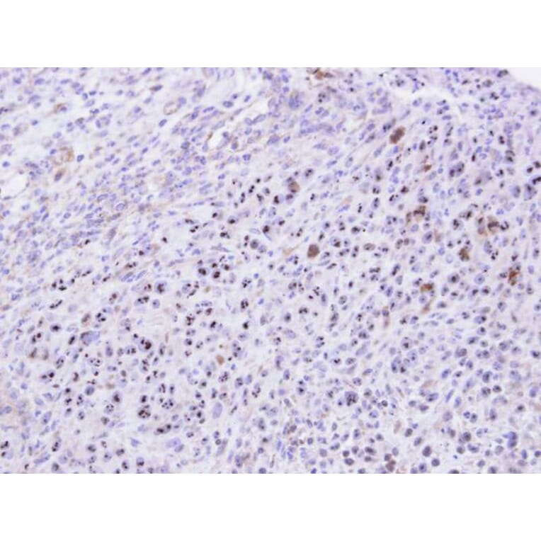 Immunohistochemistry - KRR1 antibody from Signalway Antibody (22069) - Antibodies.com