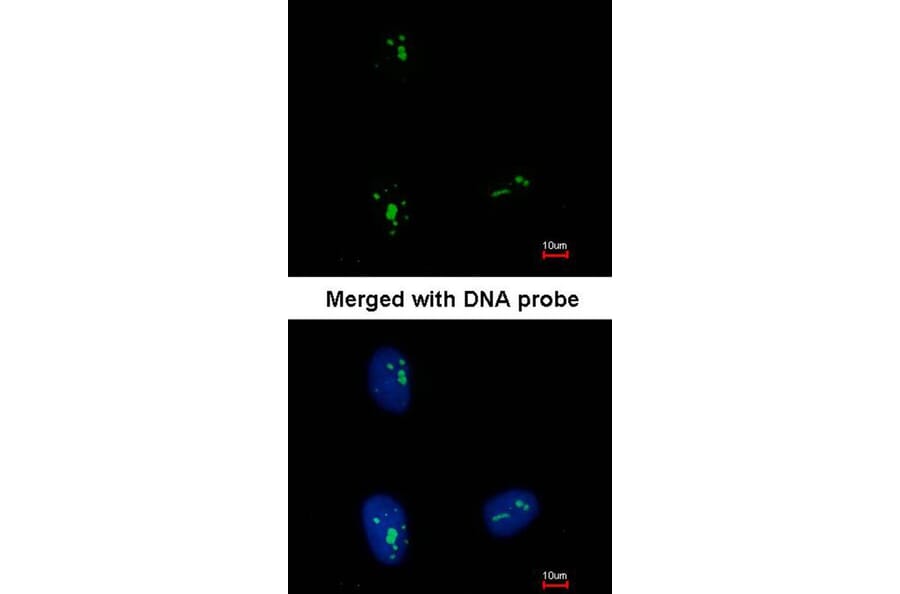 Immunofluorescence - KRR1 antibody from Signalway Antibody (22069) - Antibodies.com