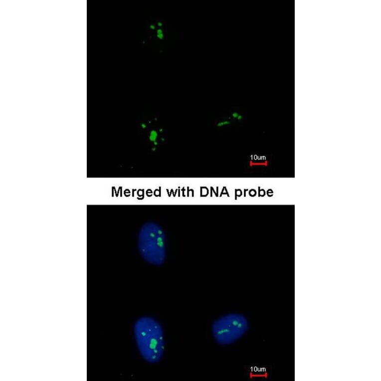 Immunofluorescence - KRR1 antibody from Signalway Antibody (22069) - Antibodies.com