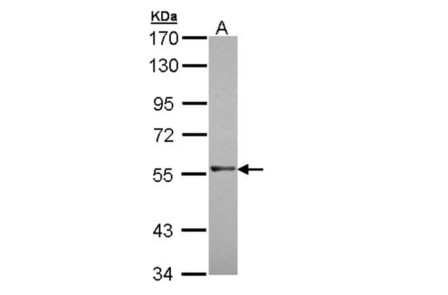 RAG2 antibody from Signalway Antibody (22074) - Antibodies.com