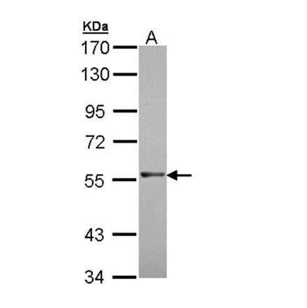 RAG2 antibody from Signalway Antibody (22074) - Antibodies.com