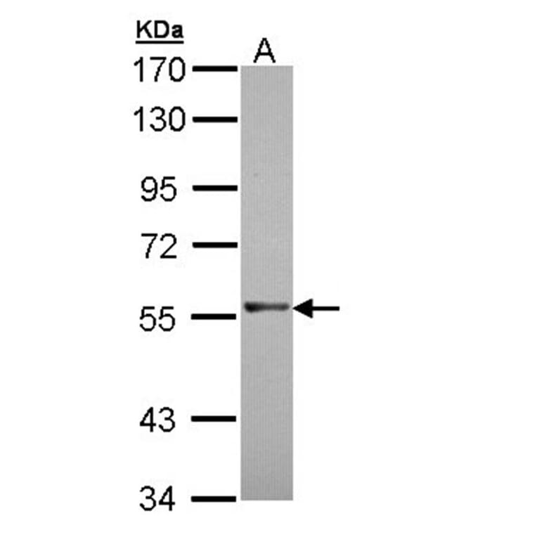 RAG2 antibody from Signalway Antibody (22074) - Antibodies.com