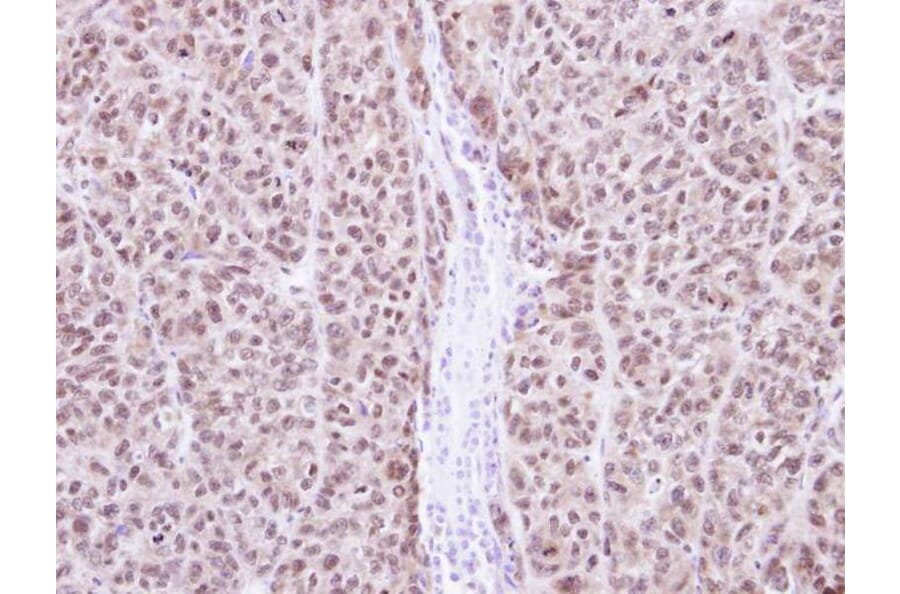 Immunohistochemistry - RAG2 antibody from Signalway Antibody (22074) - Antibodies.com