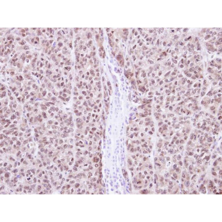 Immunohistochemistry - RAG2 antibody from Signalway Antibody (22074) - Antibodies.com