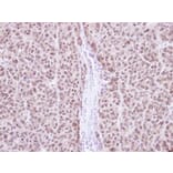Immunohistochemistry - RAG2 antibody from Signalway Antibody (22074) - Antibodies.com