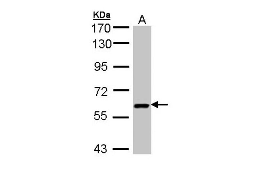 UAP1 antibody from Signalway Antibody (22080) - Antibodies.com