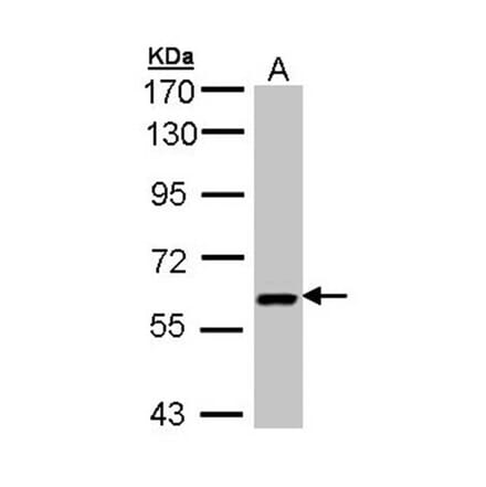 UAP1 antibody from Signalway Antibody (22080) - Antibodies.com