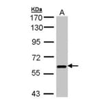 UAP1 antibody from Signalway Antibody (22080) - Antibodies.com