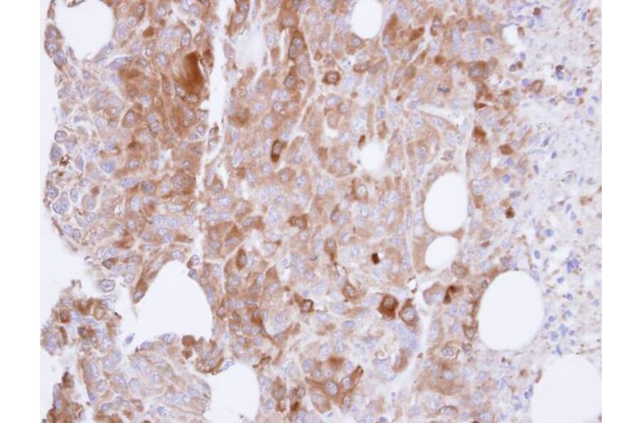 Immunohistochemistry - UAP1 antibody from Signalway Antibody (22080) - Antibodies.com
