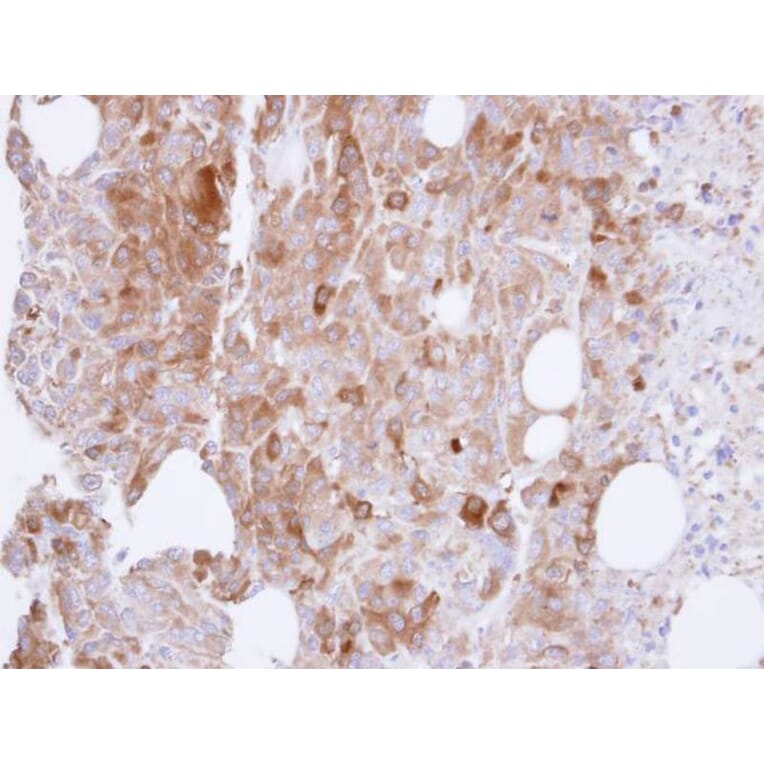 Immunohistochemistry - UAP1 antibody from Signalway Antibody (22080) - Antibodies.com