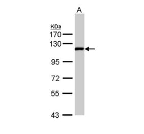 ZHX2 antibody from Signalway Antibody (22147) - Antibodies.com
