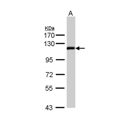 ZHX2 antibody from Signalway Antibody (22147) - Antibodies.com