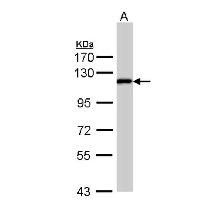 ZHX2 antibody from Signalway Antibody (22147) - Antibodies.com