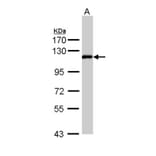 ZHX2 antibody from Signalway Antibody (22147) - Antibodies.com