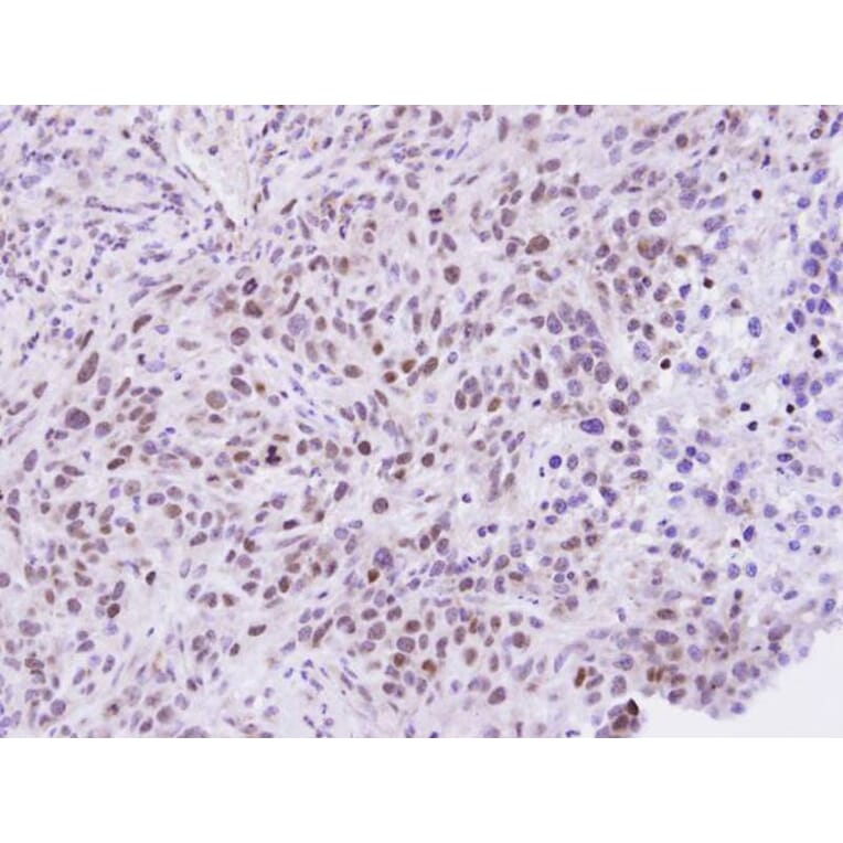 Immunohistochemistry - ZHX2 antibody from Signalway Antibody (22147) - Antibodies.com