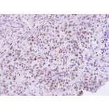 Immunohistochemistry - ZHX2 antibody from Signalway Antibody (22147) - Antibodies.com