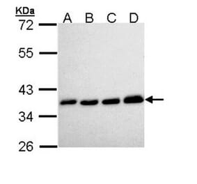 PPA1 antibody from Signalway Antibody (22152) - Antibodies.com