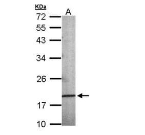 AGR3 antibody from Signalway Antibody (22294) - Antibodies.com
