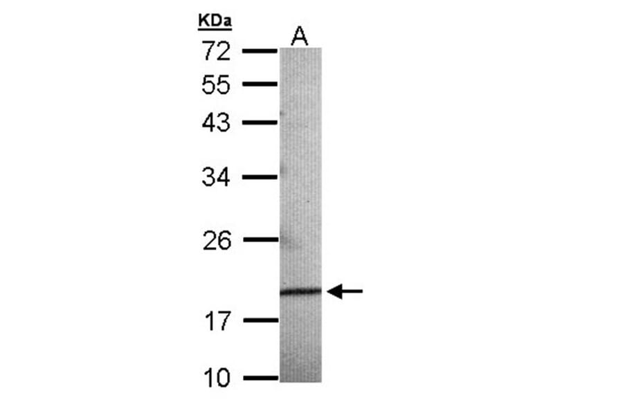 AGR3 antibody from Signalway Antibody (22294) - Antibodies.com