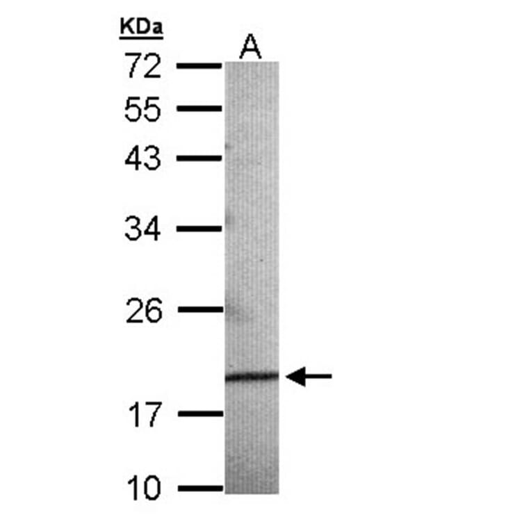 AGR3 antibody from Signalway Antibody (22294) - Antibodies.com