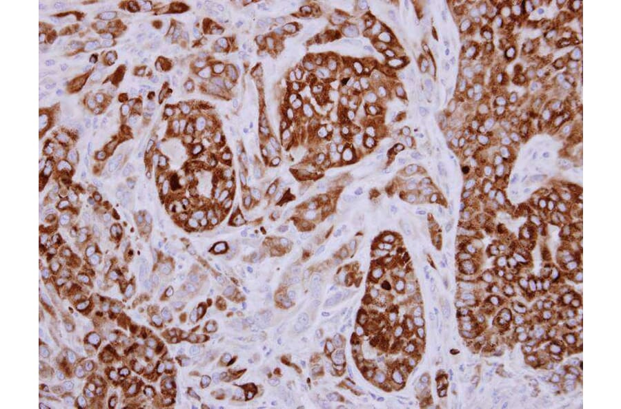 Immunohistochemistry - AGR3 antibody from Signalway Antibody (22294) - Antibodies.com