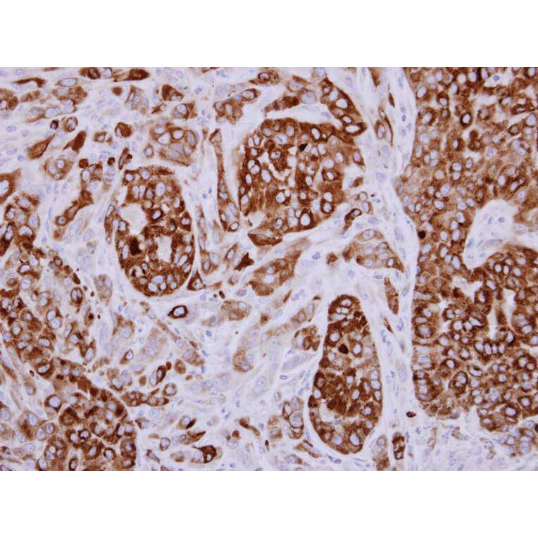Immunohistochemistry - AGR3 antibody from Signalway Antibody (22294) - Antibodies.com