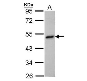 BHMT antibody from Signalway Antibody (22303) - Antibodies.com