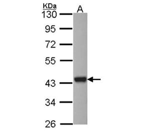 ARSA antibody from Signalway Antibody (22314) - Antibodies.com