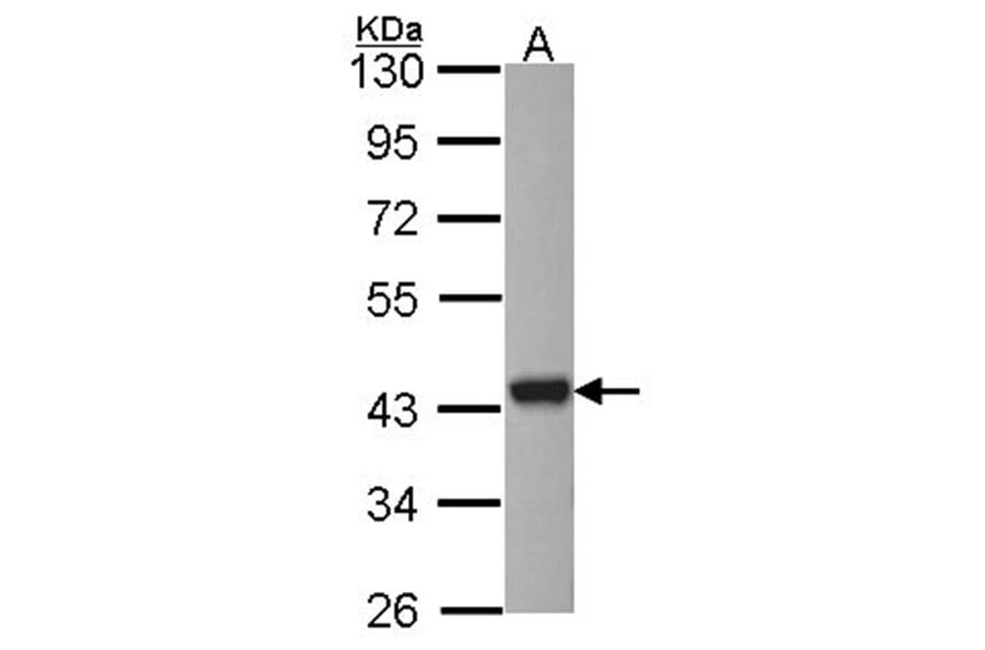 ARSA antibody from Signalway Antibody (22314) - Antibodies.com
