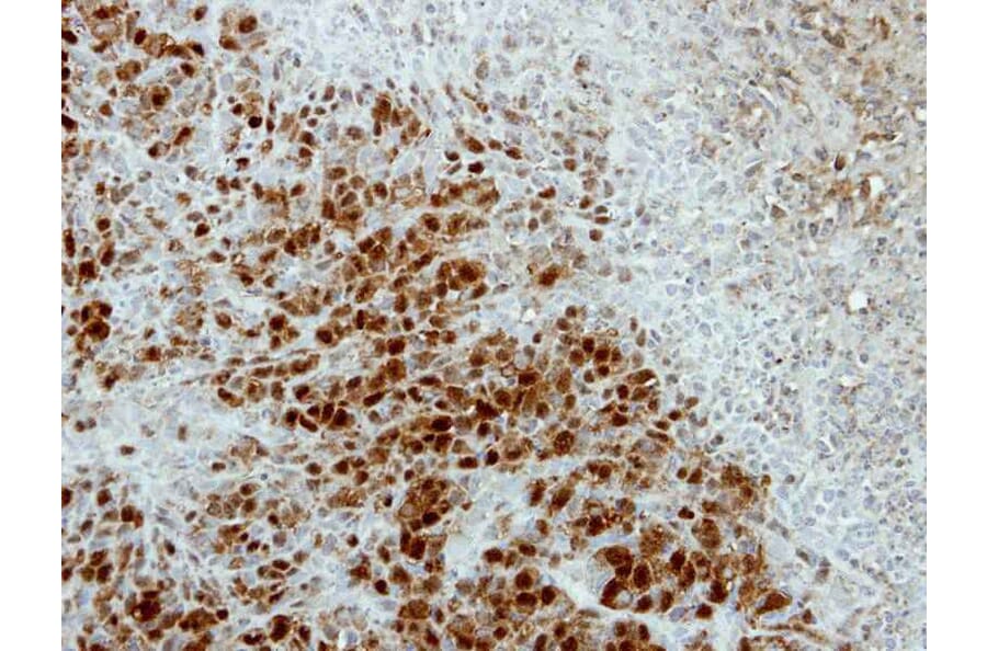 Immunohistochemistry - ARSA antibody from Signalway Antibody (22314) - Antibodies.com