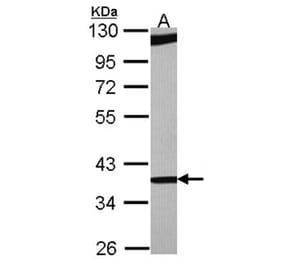 RBM4 antibody from Signalway Antibody (22419) - Antibodies.com