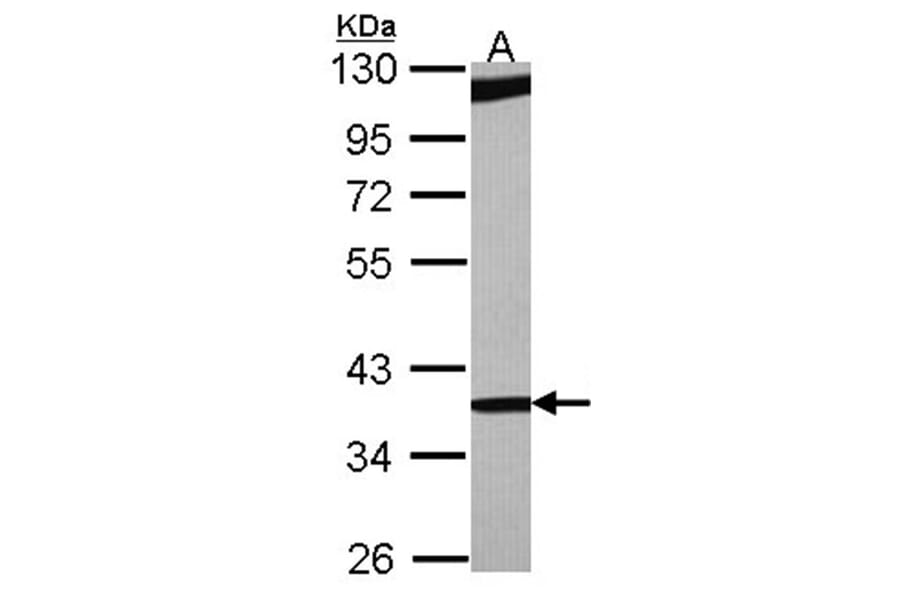 RBM4 antibody from Signalway Antibody (22419) - Antibodies.com
