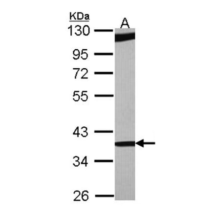 RBM4 antibody from Signalway Antibody (22419) - Antibodies.com